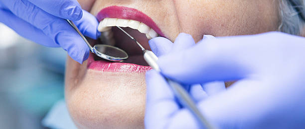 Best Broken Tooth Emergency  in Killian, LA